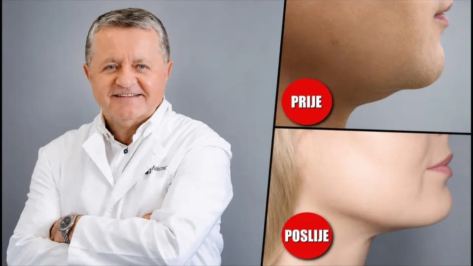 Laserska liposukcija podbratka: Kako je dr. Maletić osmislio metodu koju danas kopira cijeli svijet