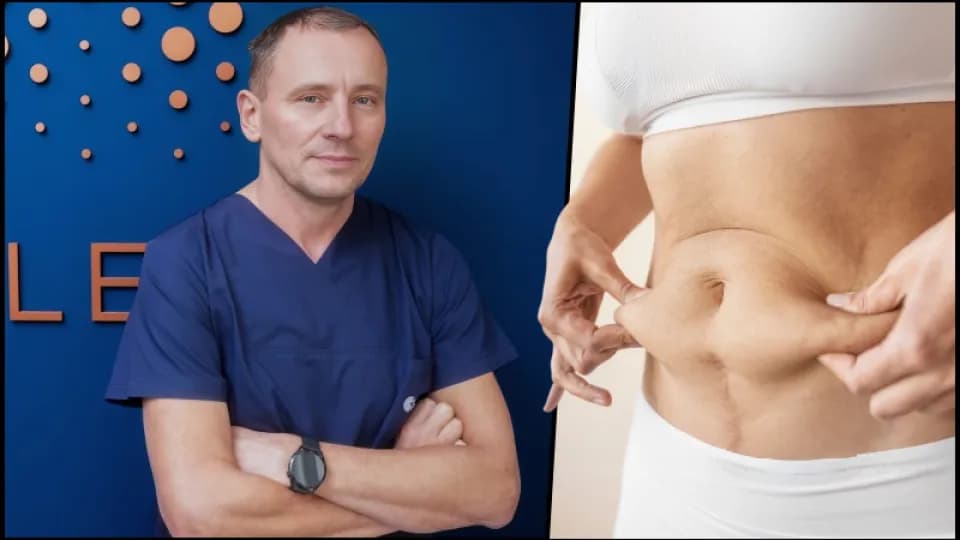 Dr. Bartol iz Poliklinike Maletić: "Klasičnom i laserskom liposukcijom mijenjamo vaše tijelo"